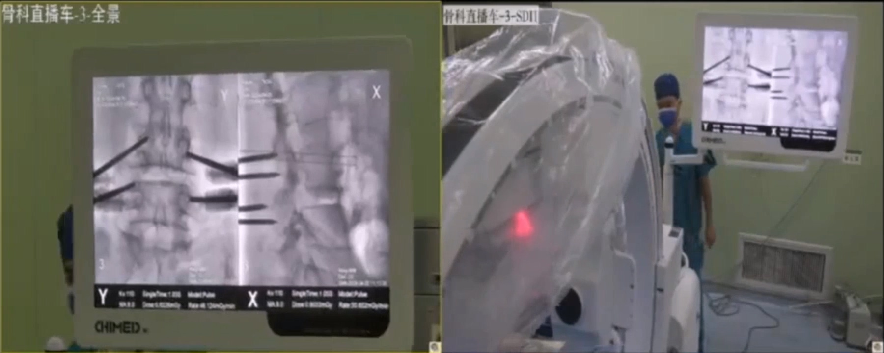 第二期识微见远，与镜同行-广西中医药大学第一附属医院全脊柱内镜下融合技术研讨会_1.mp4_20240430_094507.747.jpg